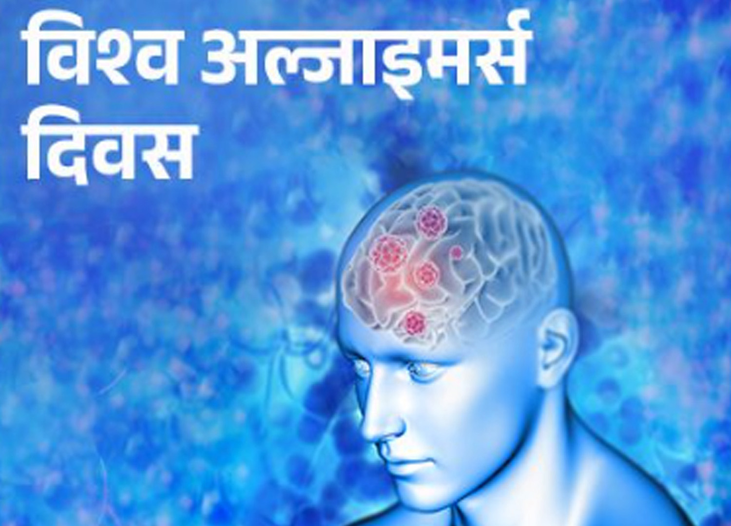 आज विश्व अल्जाइमर्स दिवस